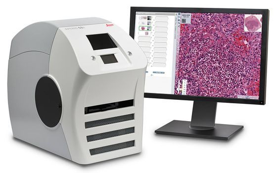 A desktop whole-slide scanner next to a monitor showing the digitized tissue in a pathology viewer.