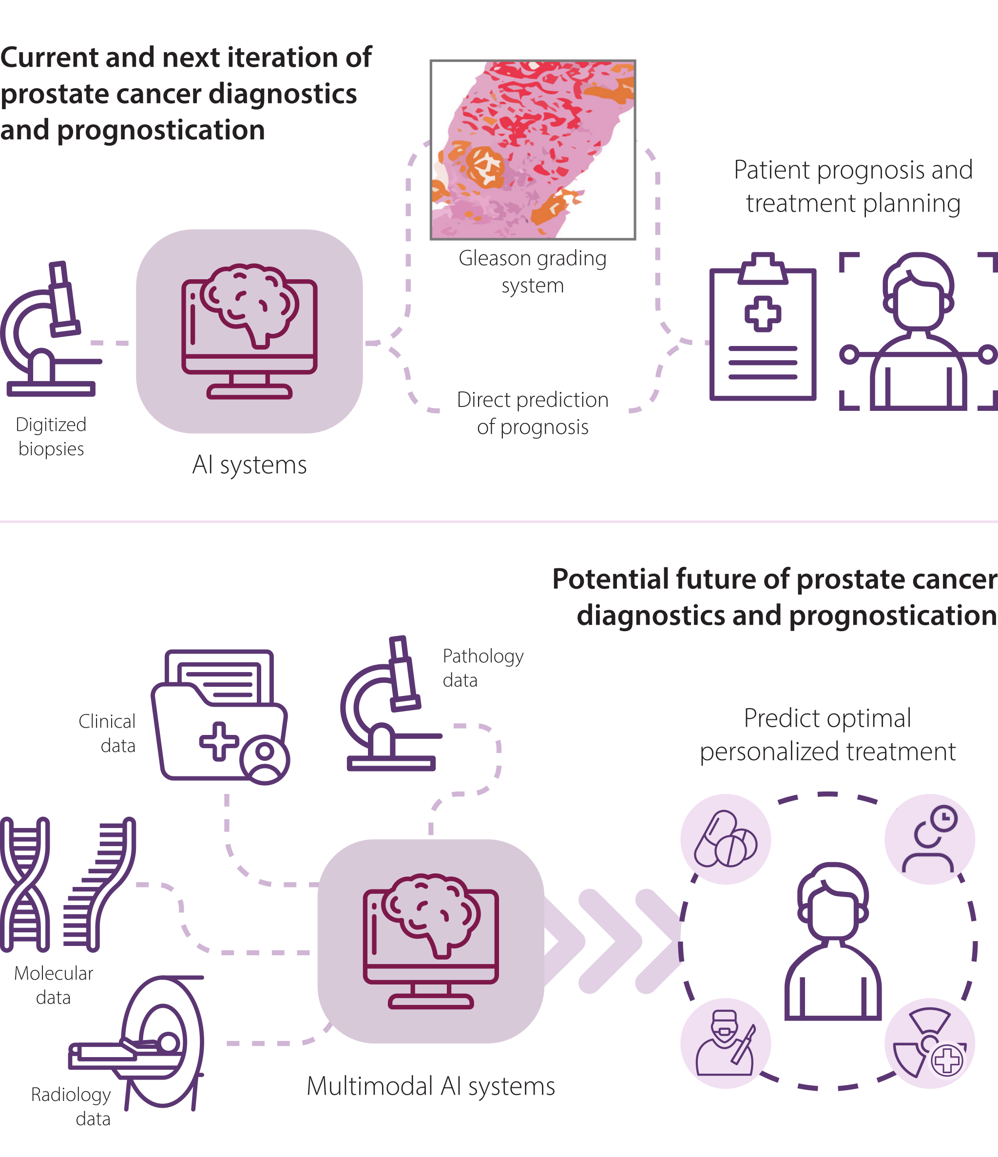 Two flow diagrams: today's AI reaching patient prognosis from digitized biopsies, either through the Gleason grading system or by direct prediction; and a future multimodal system combining pathology, radiology, molecular, and clinical data into a personalized treatment plan.