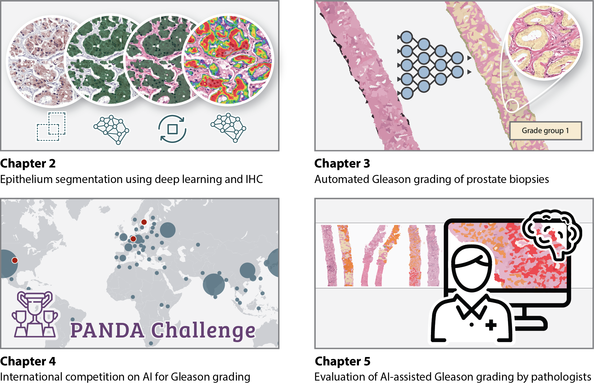 Four labelled panels, one per chapter: epithelium segmentation with IHC, automated Gleason grading of biopsies, a world map of PANDA Challenge participants, and a pathologist reading AI-marked biopsies on screen.