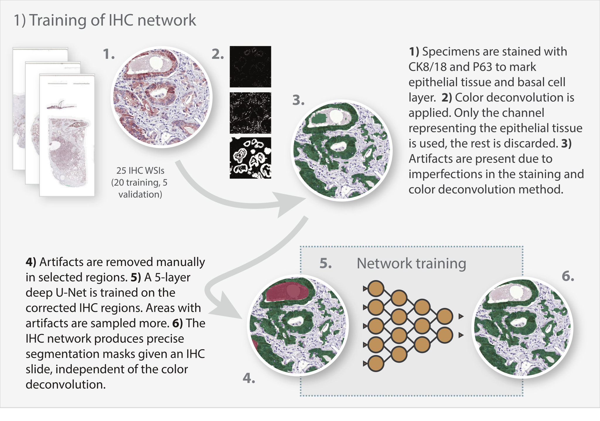 Infographic headed 1) Training of IHC network, numbered 1 to 6: a stack of 25 IHC whole-slide images, a close-up of brown-stained glands, the three channels produced by color deconvolution, the resulting green epithelium mask with red artifact regions marked for manual correction, and a U-Net diagram producing a clean segmentation mask.