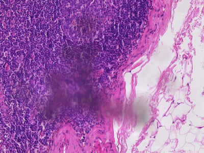 Dense purple tissue beside pale fat, with a soft grey shadow cast over the middle by dust on the slide.