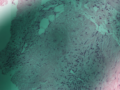 Tissue washed over with a translucent green film from a pen marking drawn on the slide.