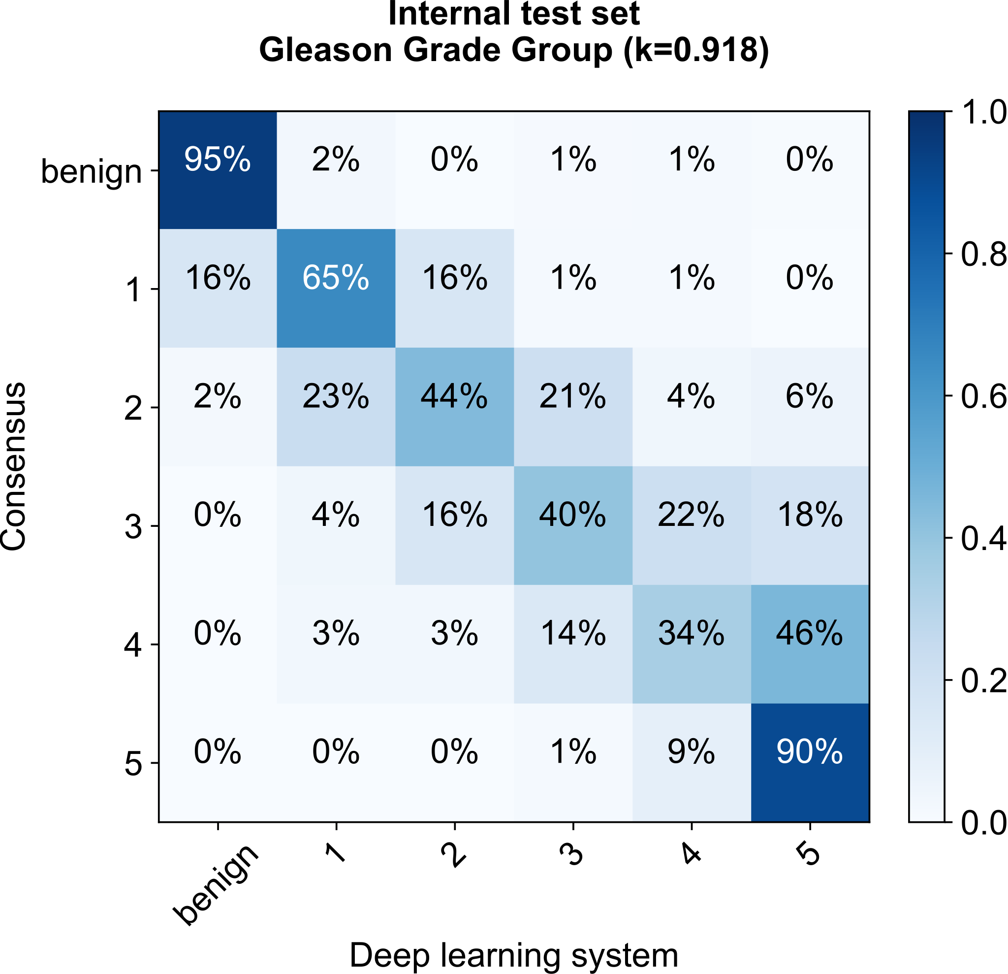The same internal test set confusion matrix as row-normalized percentages, showing 90%+ agreement at the benign and grade group 5 extremes and more spread in the middle grades.