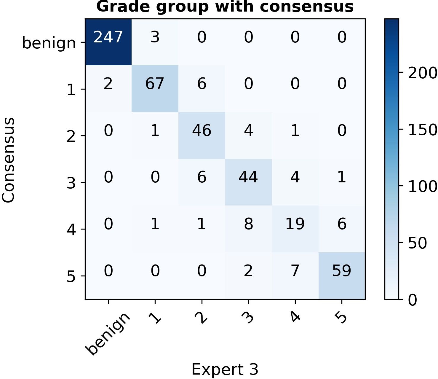 Confusion matrix of grade-group counts, consensus versus Expert 3, with a strong diagonal similar to Expert 1.