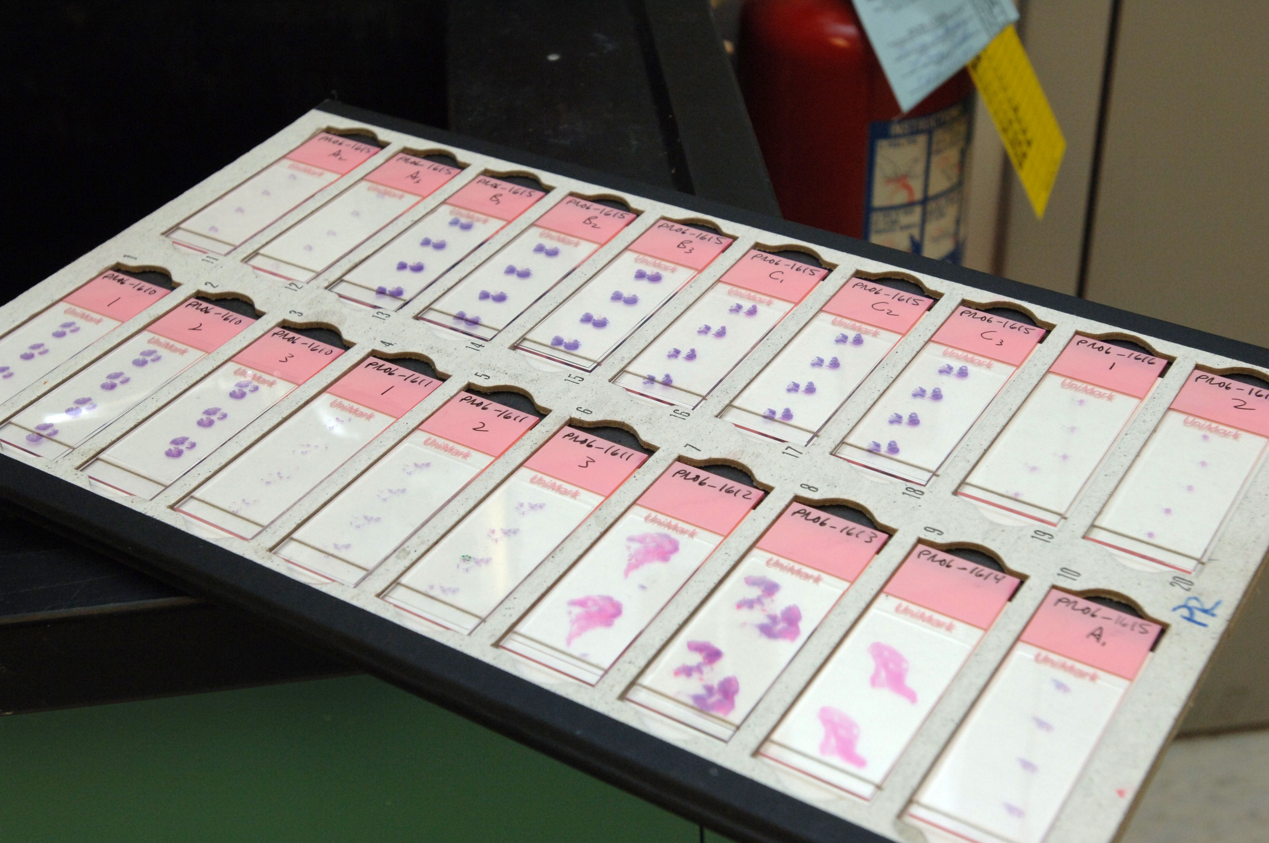 A tray of hand-labelled glass slides on a lab bench, each carrying a small pink and purple stained tissue section.