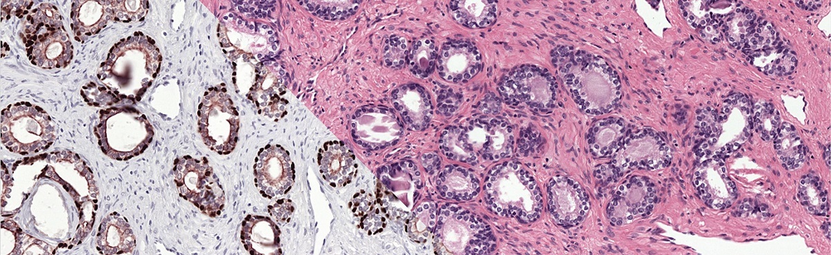 To train our system we make use of registered H&amp;E and IHC stained slides. Registration makes it possible to transfer annotations from one domain to the other.