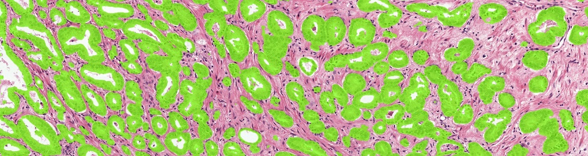 Example of the ground truth segmentation of the epithelium tissue.