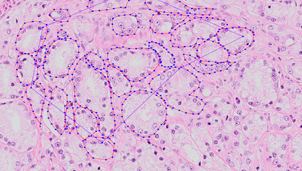 Example of annotated training data. Many of these regions were annotated by hand. The annotated epithelial glands are outlined in red.